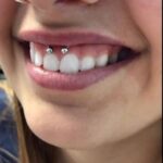 smiley piercing