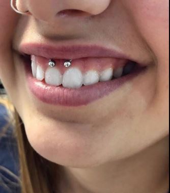 smiley piercing