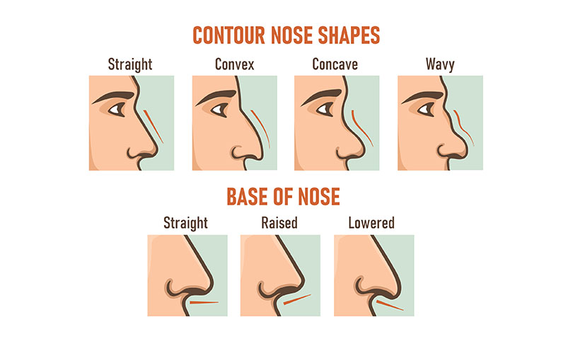 types of noses